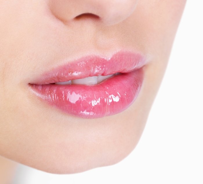 Lèvres après injection d'acide hyaluronique
