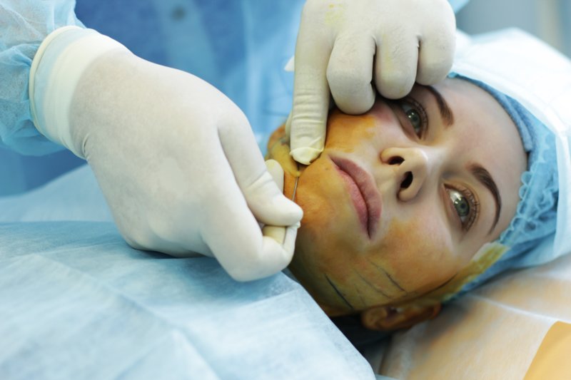Posibile complicații și consecințe ale ridicării feței cu mesothreads
